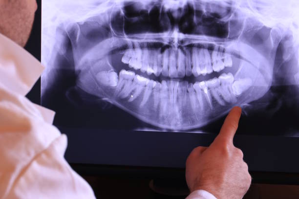 Best Cracked Tooth Emergency Dentist  in Mariposa, CA